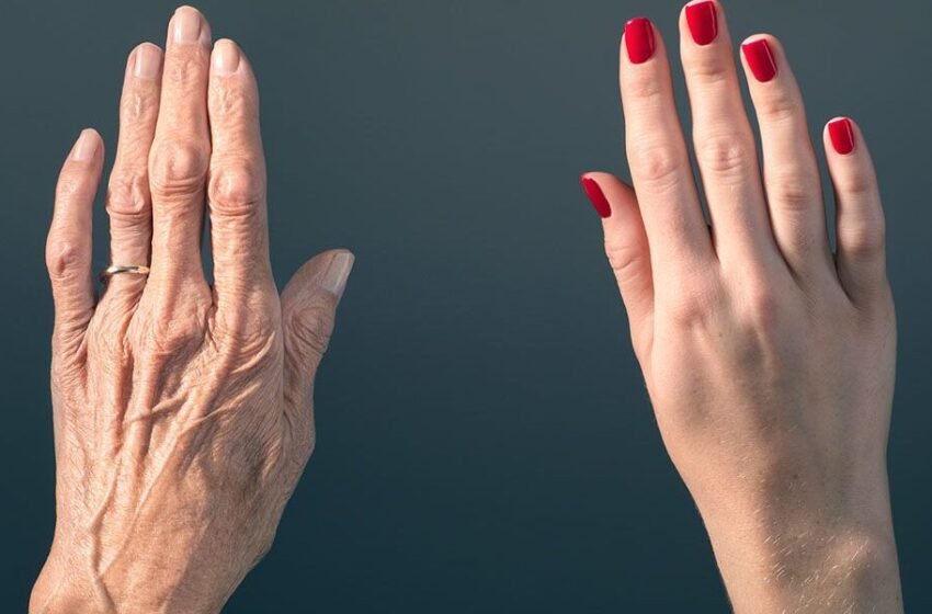  Thonjtë tuaj ndryshojnë me kalimin e moshës – ja si të kujdeseni për ta, sipas dermatologëve
