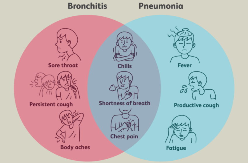  Bronkiti apo inflamacioni i mushkërive – si të konstatoni më së lehti cili është problemi