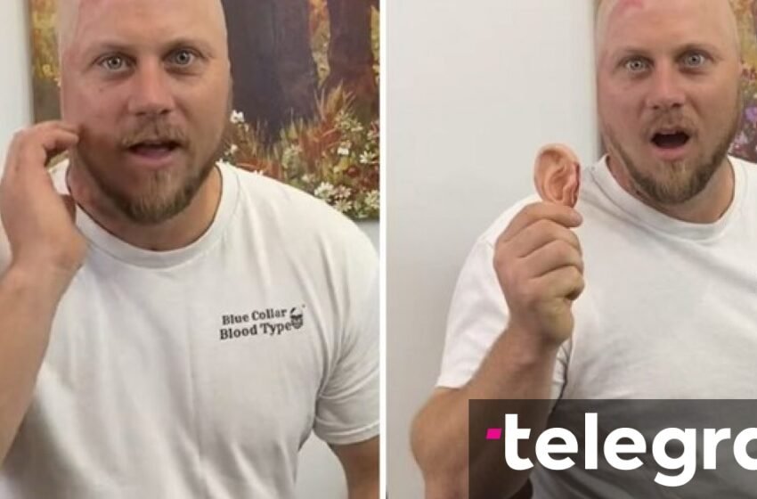  I mbijetoi një goditjeje prej 4100 voltësh: Tani është yll në rrjetet sociale, bën shaka në mënyra të çuditshme