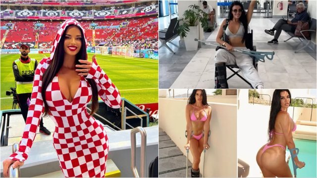 Aksident i pakëndshëm gjatë pushimeve në Mykonos, tifozja më seksi e Botërorit përfundon në karrige me rrota