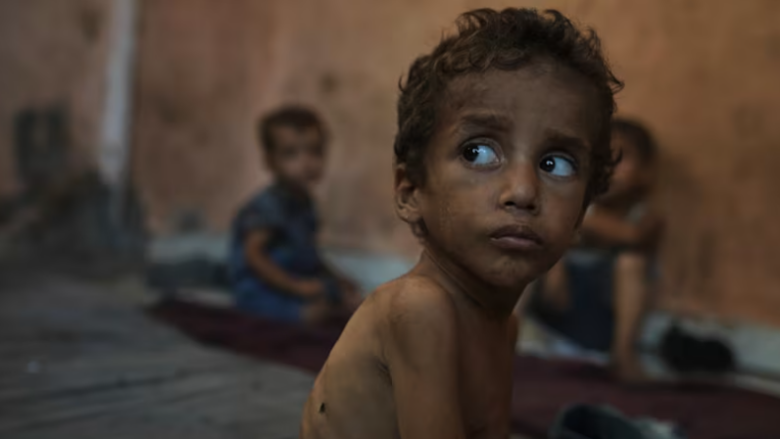 OBSH: Asnjë ulje e urisë që nga armëpushimi në Gaza