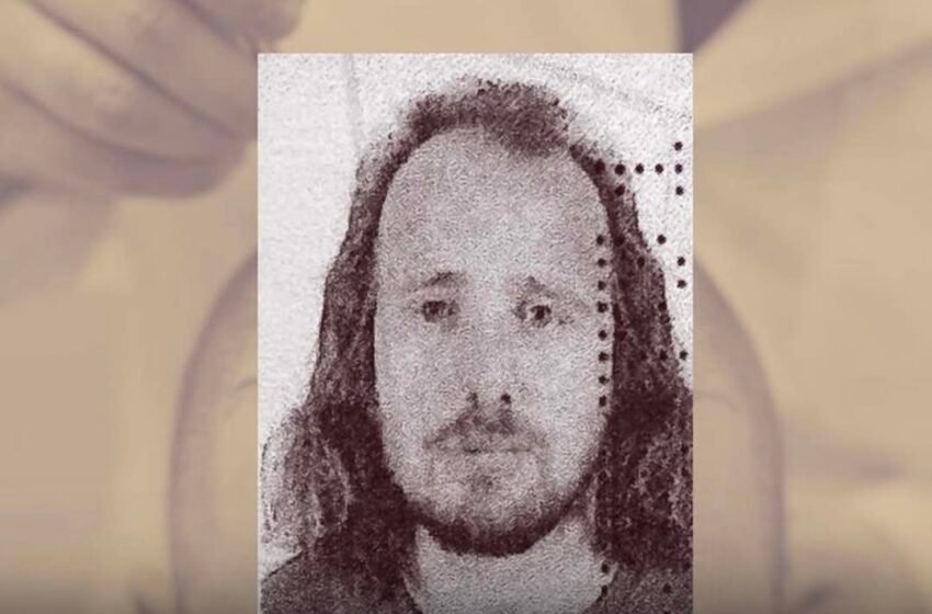  Shkoi në Turqi për të mbjellë flokët, vdes pas transplantit 36-vjeçari shqiptar