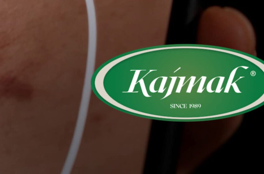  Pa kontratë dhe me pretendime se u sulmua fizikisht – rrëfimi i punëtorit që akuzon drejtorin për dhunë në kompaninë Kajmak