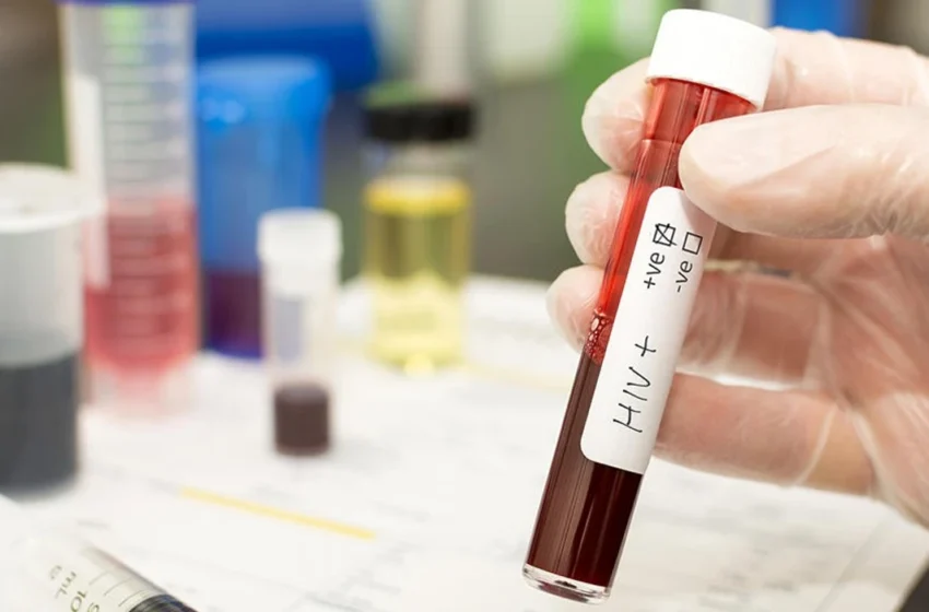  Në korrik janë regjistruar 11 raste të reja me HIV/AIDS, më i riu është 20-vjeç